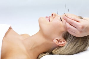 Acupuncture-therapy-alternative-medicine
