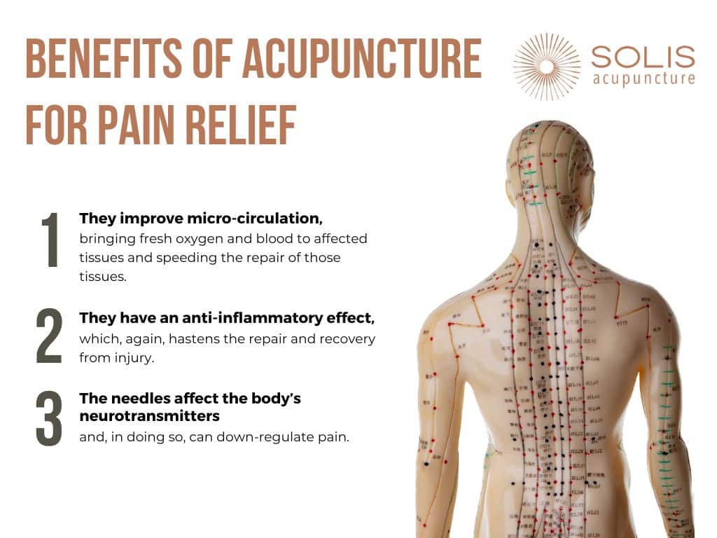 Acupuncture Pain Relief Mechanism At Willie Liggins Blog