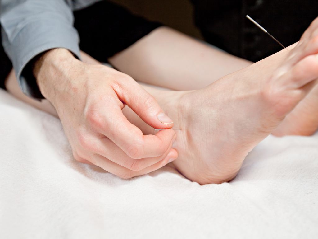 Plantar Fasciitis Acupuncture Points